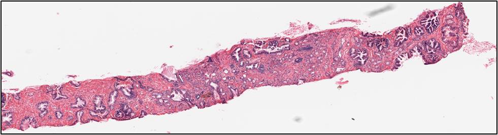 normal cells